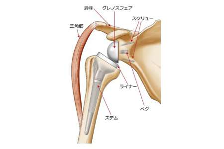 Test（人工肩関節置換術について） | 神戸にある整形外科医院・おかだ 